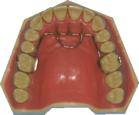 orthodontie, appareil de graber