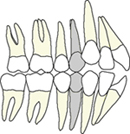 orthodontie, appareil multi-attaches, appareil multi-bagues, étapes, étapes 1